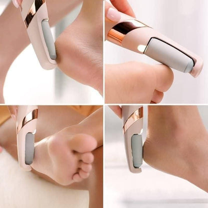 Electronic Cordless Pedicure Callus Remover – Polishing Tool